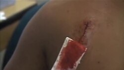 哥倫比亞炸彈爆炸兩死三十七傷