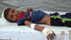 Menace de choléra en Ukraine