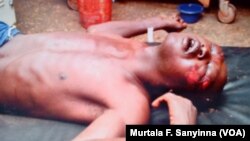 Jamilu Abdullahi, dauke da alamun dukar da 'yan Civil Defence suka yi masa a Ofishinsu na Sokoto South