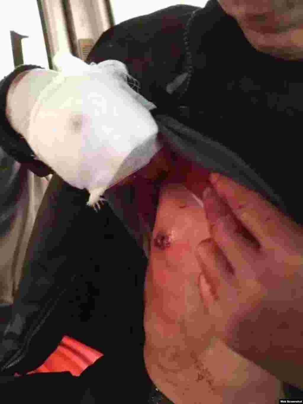 江西上饶鄱阳县饶埠镇数以千计村民抗议附近化工厂污染（博讯、微博等网络图片）