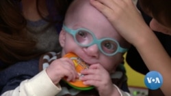 Cleft Lip and Cleft Palate: No Reason Not to Live a Normal Life