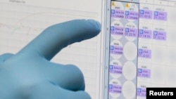 A medical researcher uses a monitor that shows the results of blood tests for various diseases, including Zika, at the Gorgas Memorial laboratory in Panama City, Feb. 4, 2016.