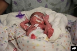 FILE - Hospital staff prepare "preemie" twin Olivia Niedermeyer to undergo an eye exam at Advocate Children's Hospital in Chicago, March 15, 2016.