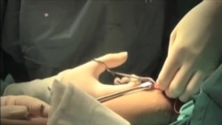 激光技术弥合伤口，天衣无缝不留痕