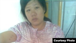 潘春烟被打引产针后身上有反抗造成的伤痕 (Xu Can blog)