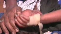 Global Immunization: Despite Successes, Much More to Do