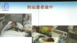 中國報告第44宗H7N9禽流感死亡病例