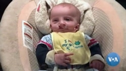 Most Babies Born With Cleft Condition Could Die Without Surgery