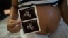 FILE - Isabela Cristina, 18, who is six months pregnant, shows a photo of her ultrasound at the IMIP hospital in Recife, Pernambuco state, Brazil.
