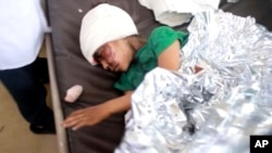 一名在空襲中受傷的也門兒童在薩那醫院裡被救治。 （2018年8月9日）